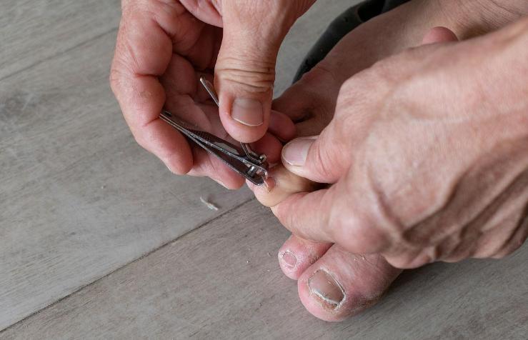 脚趾甲往肉里长又疼又痒教你一招,脚趾甲总往肉里扎该怎么办