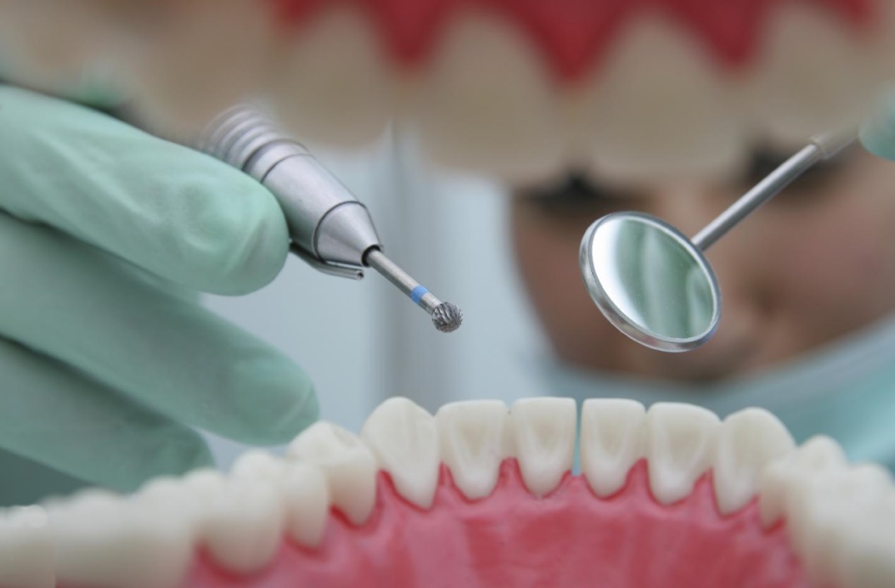 美国牙医故意钻坏病人的牙齿再做修复手术，5年毁掉上千颗牙