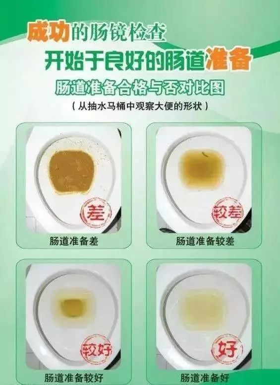 胃肠镜详细流程,带你们了解做胃肠镜过程