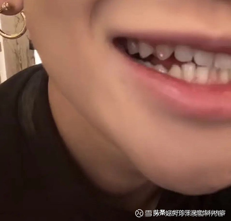 珍珠计划图片,珍珠计划2018