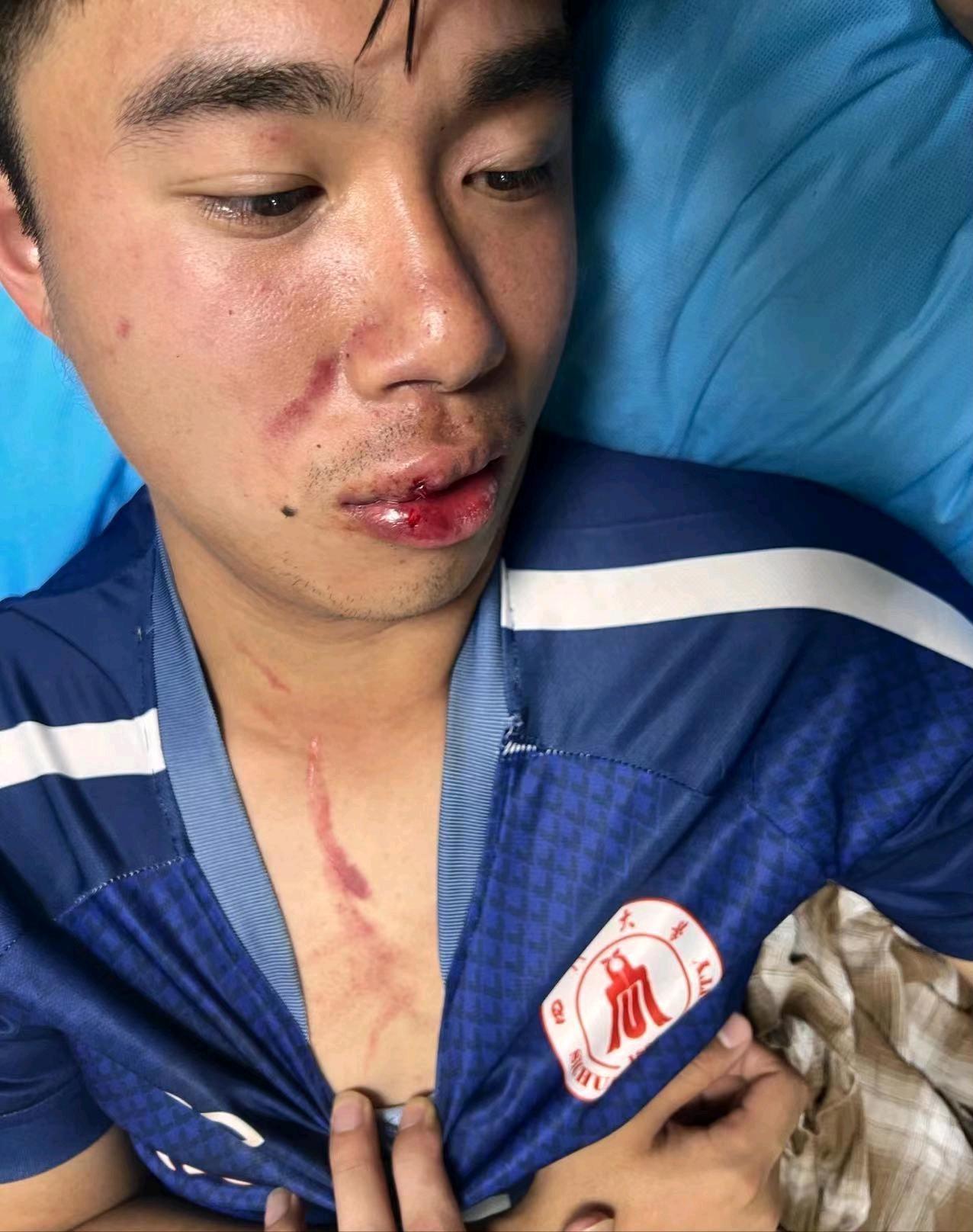 湖北大学冲突事件后续打人者,校霸挑衅体育生被群殴