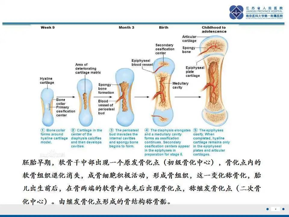 胫骨结节软骨炎要怎么治疗,胫骨结节骨软骨炎会癌变吗