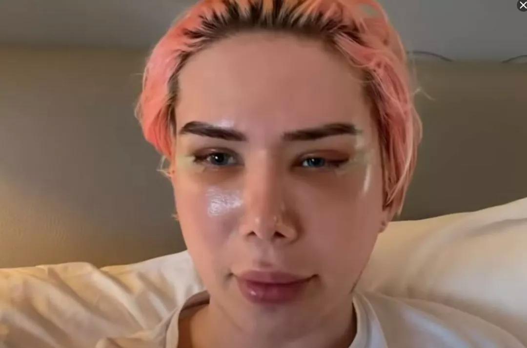 疯狂整容的网红,美国白人网红整成韩国人