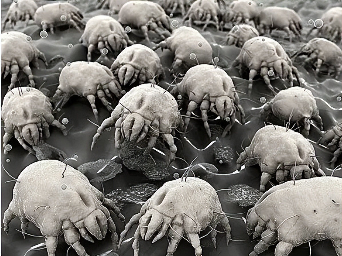 床上螨虫怕的不是“暴晒”？教你卧室放点“它”，螨虫消失了