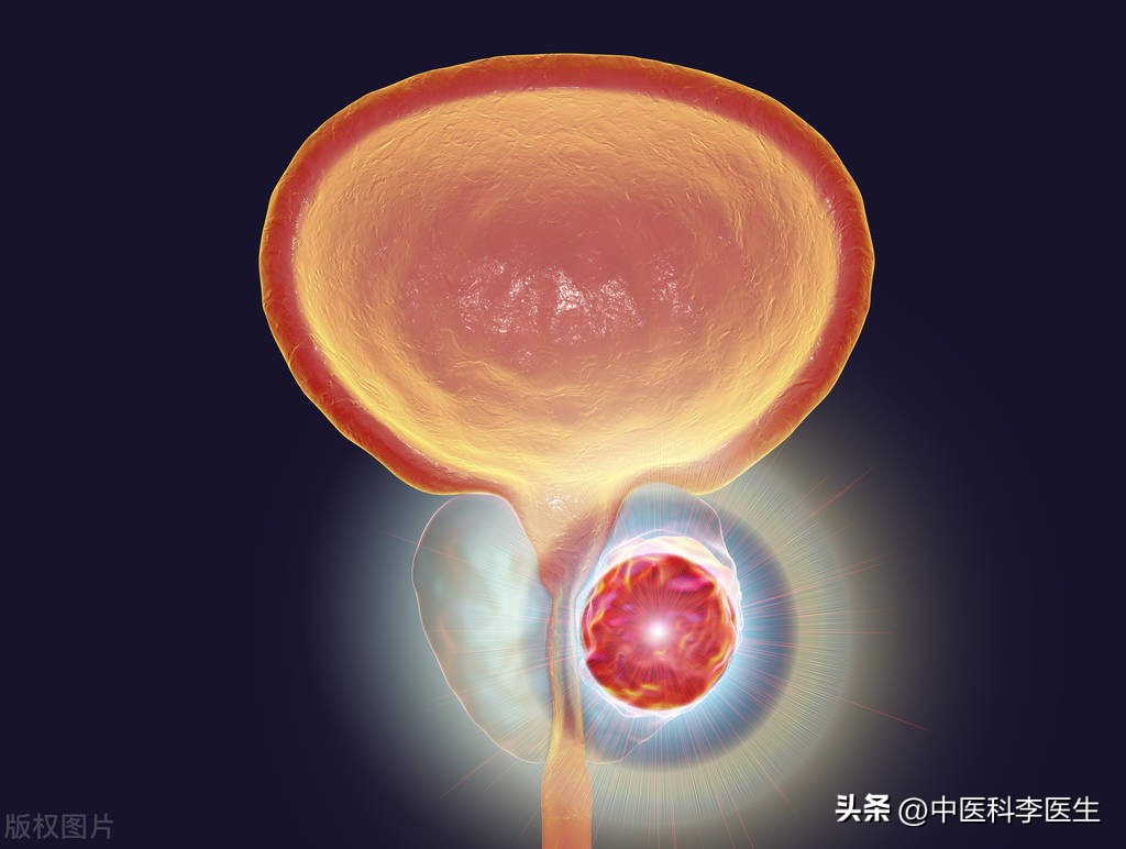 早期17种癌症治愈率排名,早期癌症治愈率最大可达95%以上