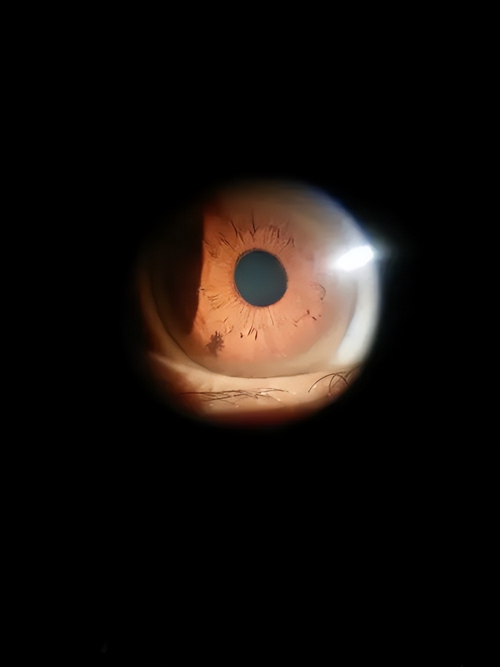 22岁月经紊乱需警惕,女性出现月经紊乱