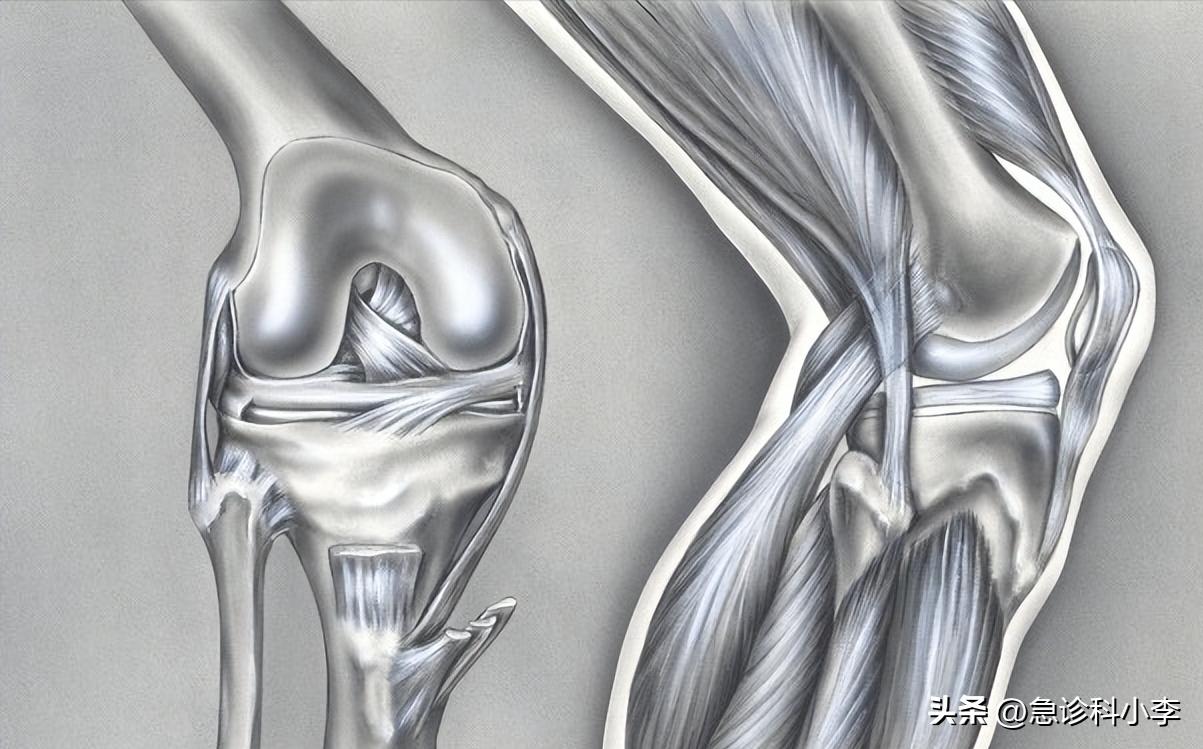 老人家膝盖半月板疼痛的治疗方法,65岁老人半月板损伤膝盖痛