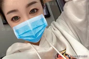 做双眼皮20天大小眼,做双眼皮二十几岁做最好