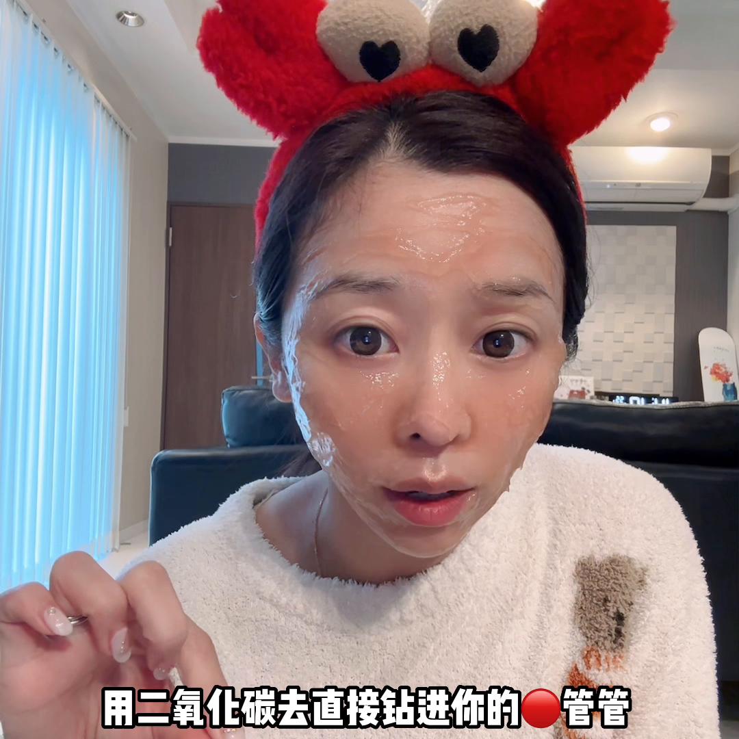 鏃ユ湰闄㈢嚎纰抽吀闈㈣啘,闄㈢嚎纰抽吀闈㈣啘