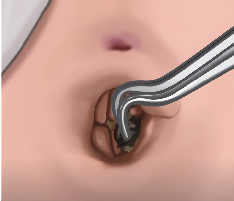 2023最火手游营销：点点、天龙都在用的ASMR副玩法，*载下**立涨100%