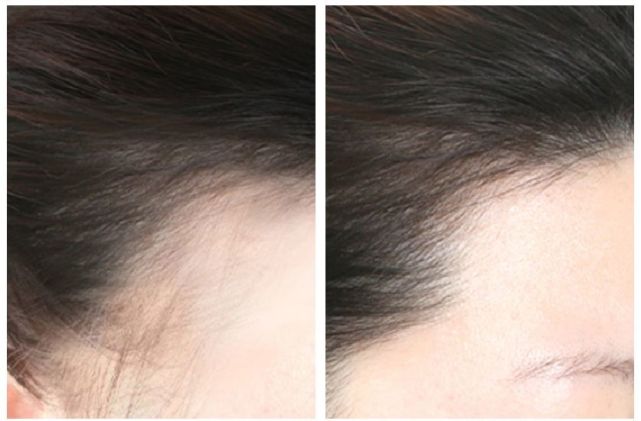 超市这些洗发水千万别买,千万不要买的四种洗发水