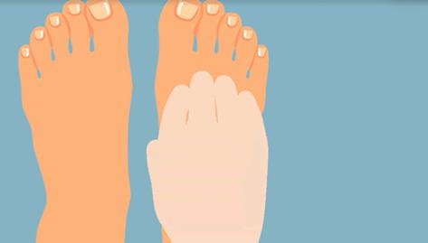 一走路脚趾甲里疼怎么回事,甲沟炎拔完脚趾甲很疼怎么办