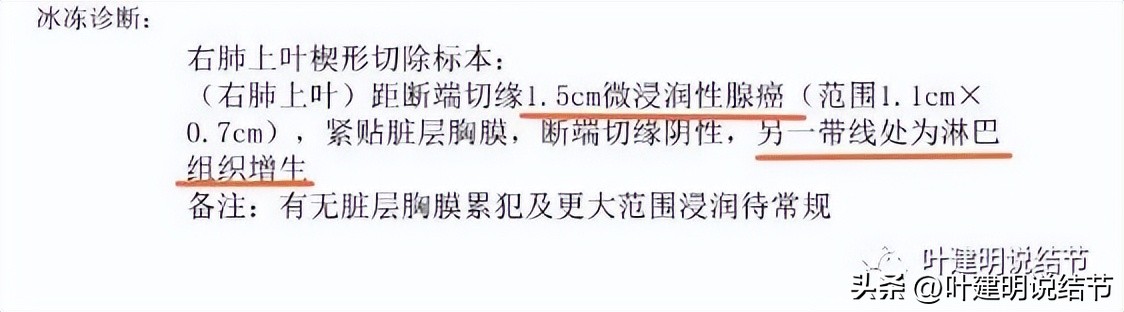 磨玻璃结节伴有增生是癌症吗,磨玻璃结节会是别的癌转移的吗