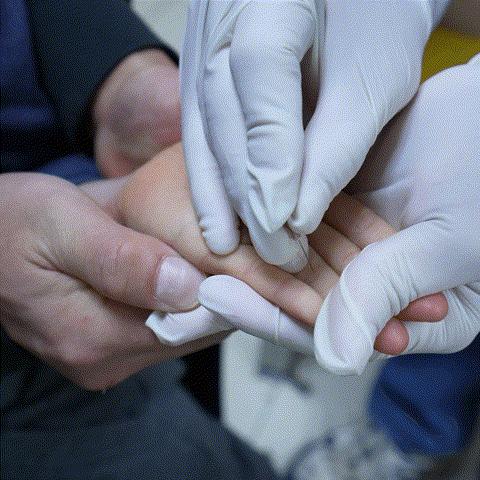 宝宝有疳积是不是喂养不当导致的,疳积适合多大的孩子吃饭