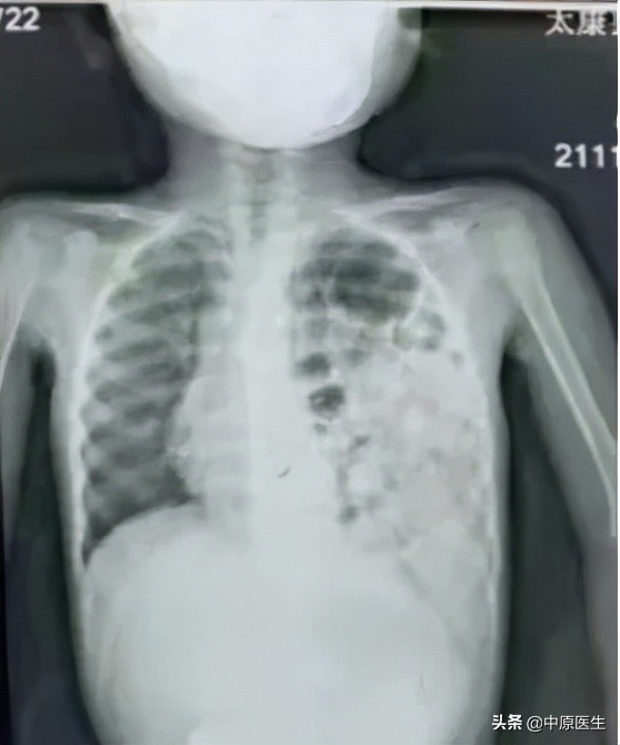 4岁孩子经常呕吐,4岁小孩吐了连续三天