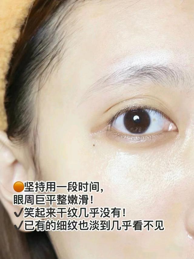三四十妈妈用什么眼霜,30-40岁最适合的眼霜怎样用