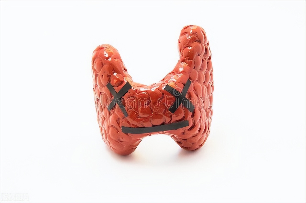 64岁女患者脖子肿痛，病因为何？多学科诊疗让患者获益最大化