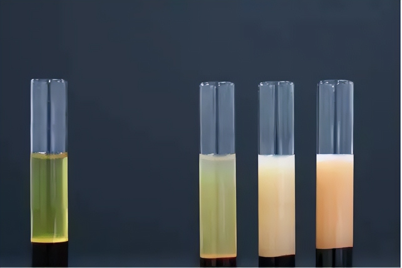 每年体检查血应该查哪些方面,体检生化免疫检查结果什么意思