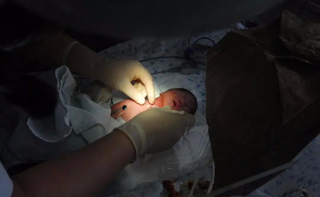 农村医生给孕妇剖腹产,28岁孕妇剖腹产孩子刚出生