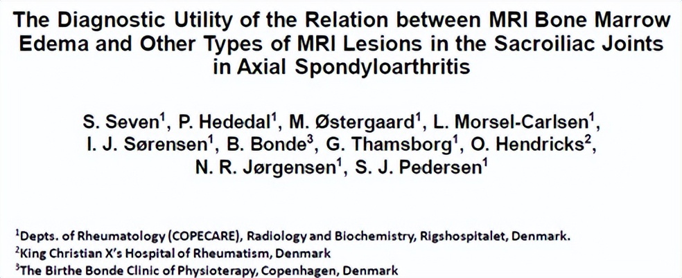骶髂关节骨髓水肿最好的治疗方案,骶髂关节水肿是强直性脊柱炎吗