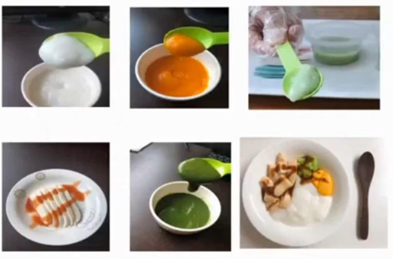 “难咽之痛”——吞咽障碍如何应对？