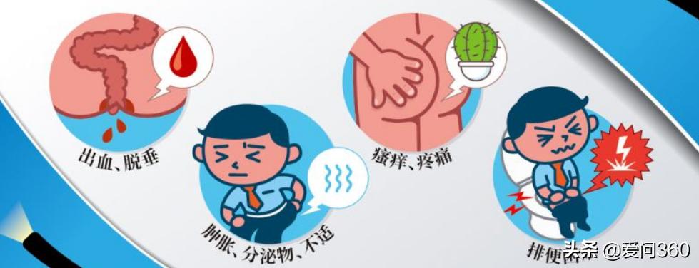 痔疮的预防方法主要是什么,关于痔疮的9个防治常识