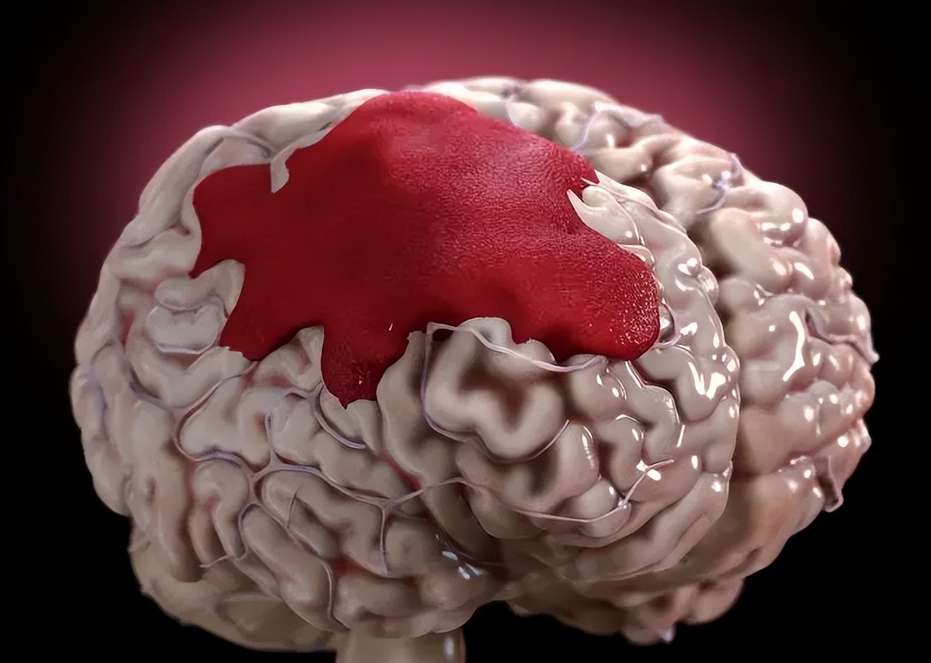 22岁女孩洗完澡突然晕倒后续,22岁女孩洗完澡后昏迷后续