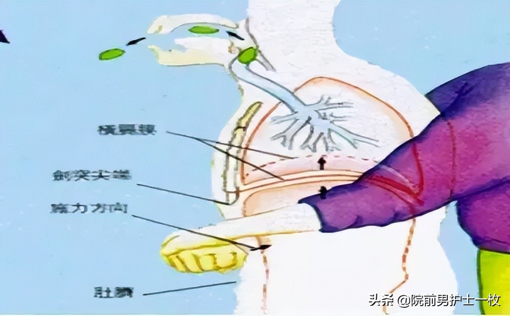 紧急救援海姆立克急救法,三分钟学会海姆立克急救法