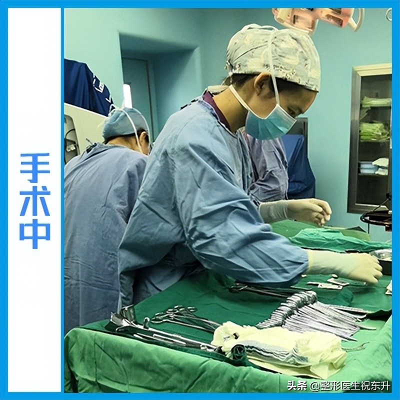面诊后拉皮除皱,小切口拉皮手术后第一天记录一下