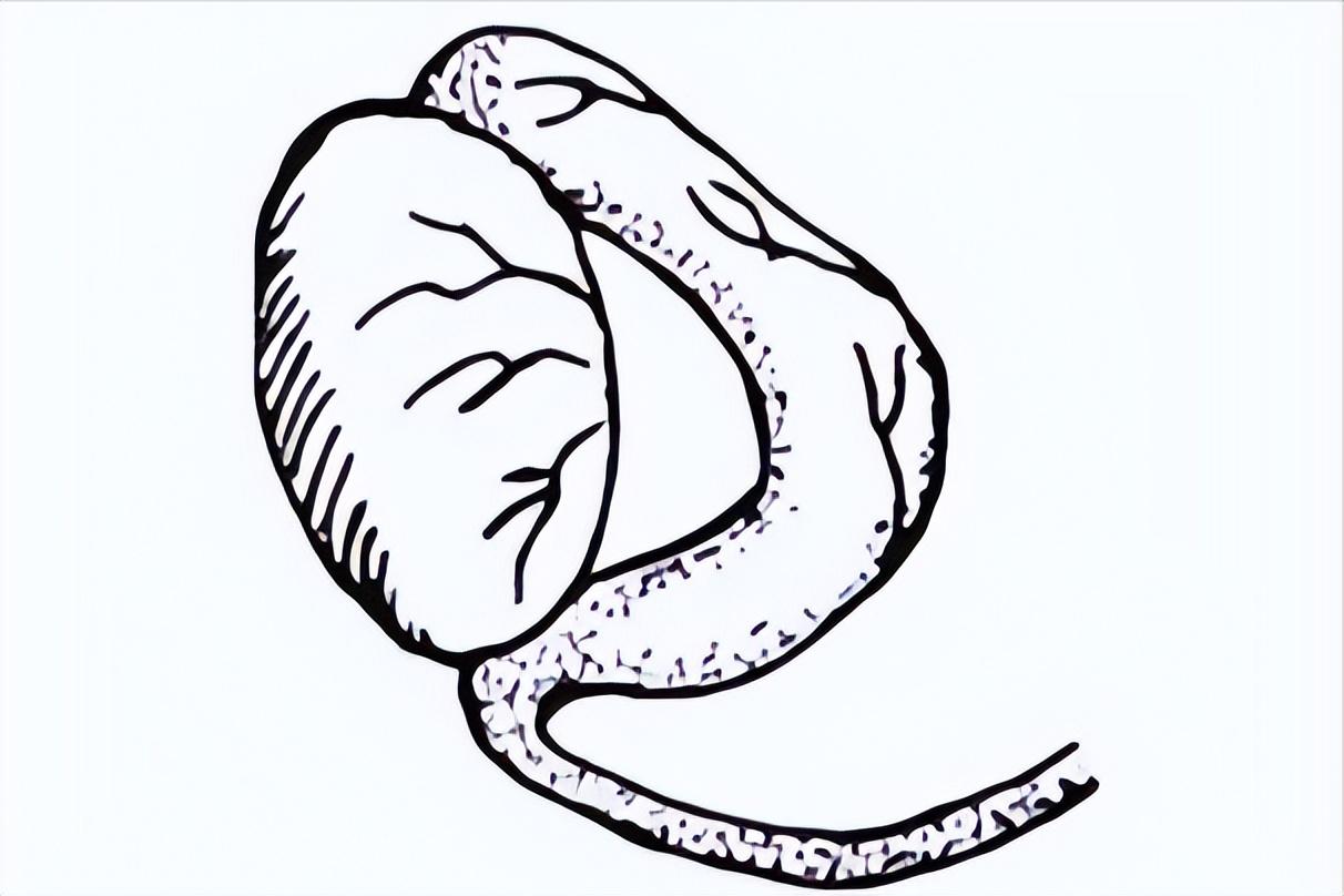 精子出现问题有哪些,精子一般有些什么问题