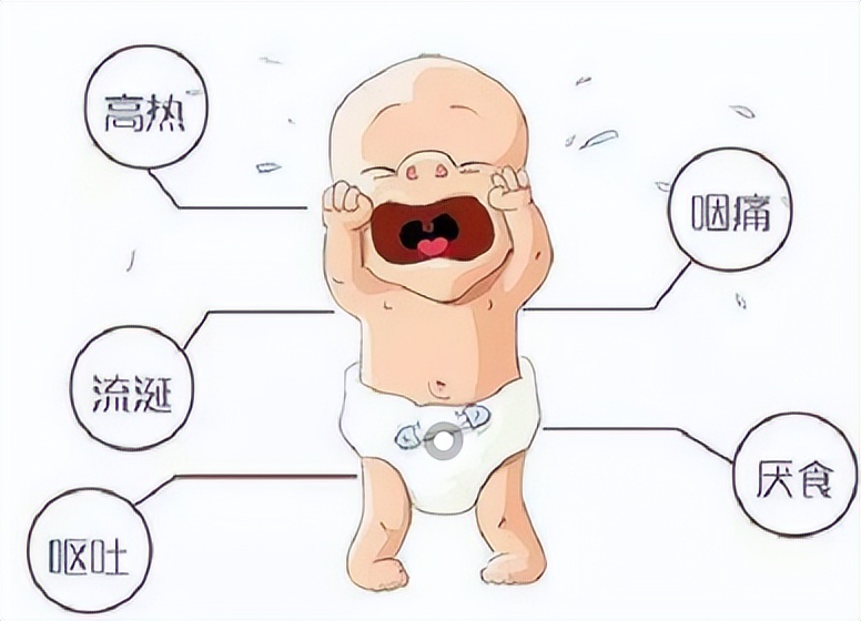 儿童急性扁桃体炎症状及治疗,急性扁桃体炎的主要并发症是什么