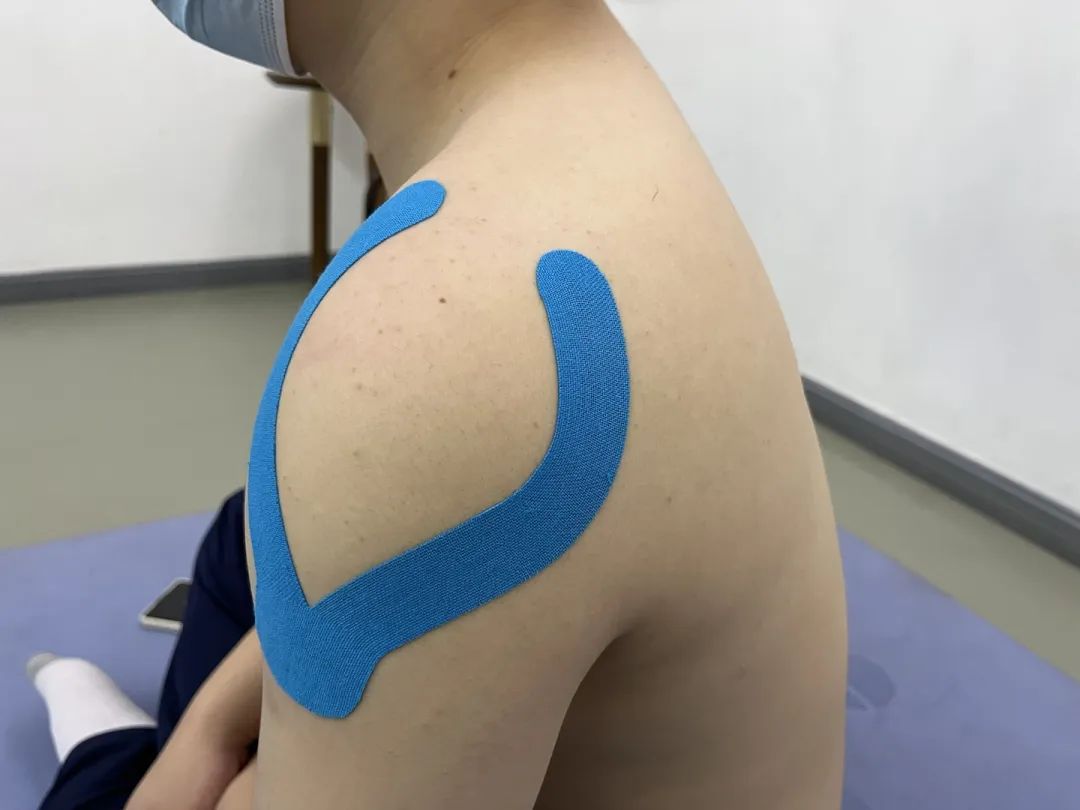 肌效贴颈椎使用方法图解,肩膀疼肌内效贴使用方法