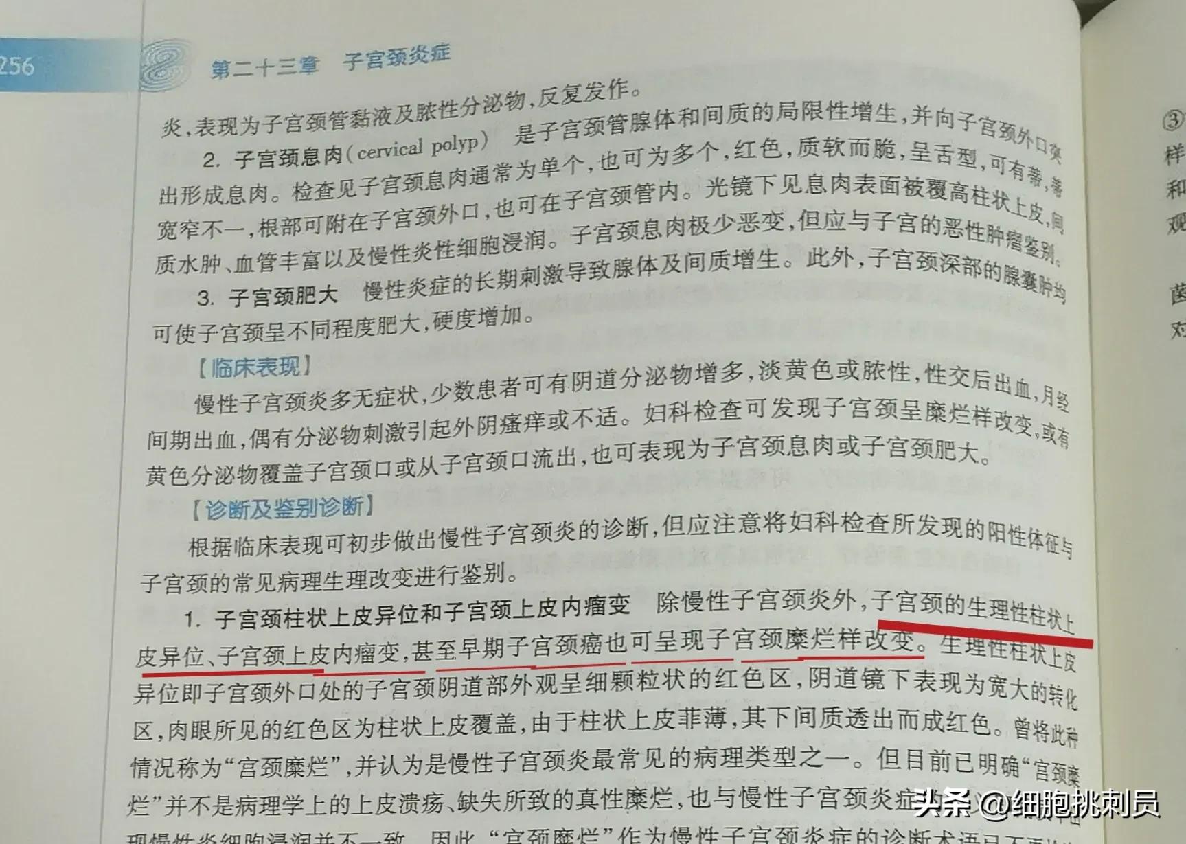 宫颈炎和宫颈糜烂是一种病吗,不用管的病宫颈糜烂