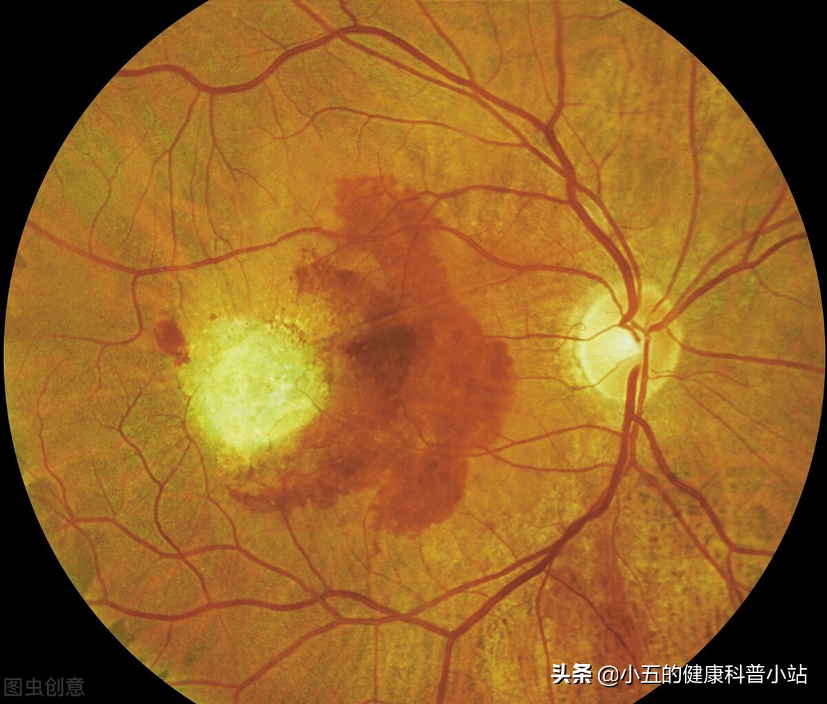 老年人视力退化应该吃什么维生素,老年人视力不好吃什么能提高视力