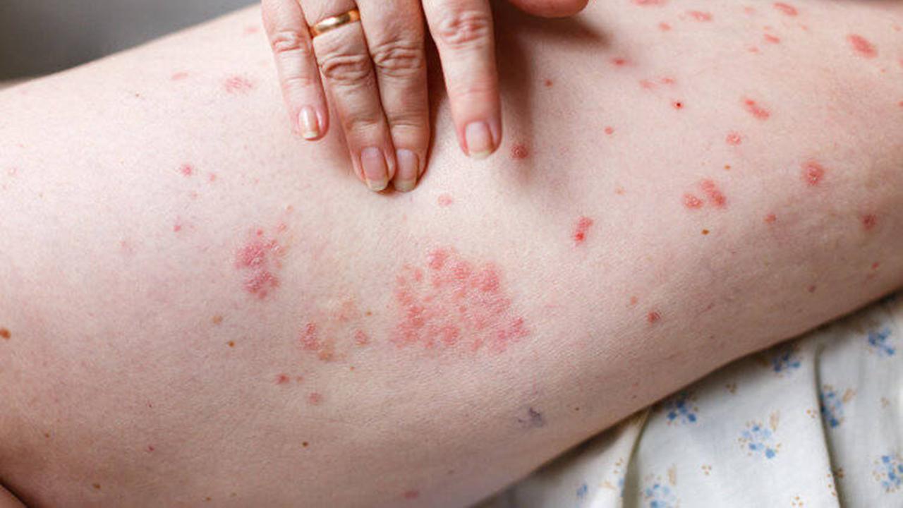 辟谣丨抗生素就是消炎药吗？两大常用抗生素，很多人都用错了