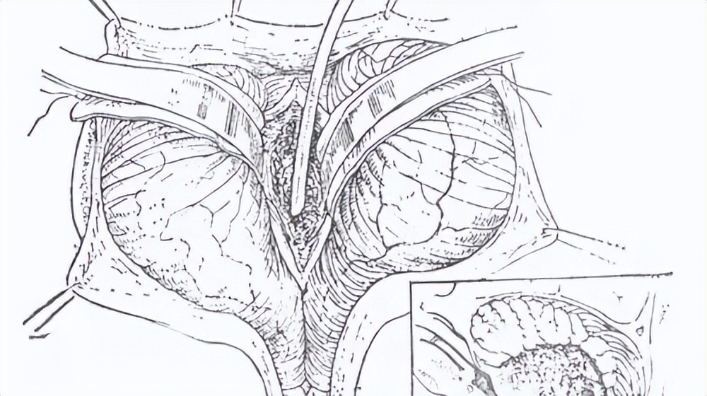 儿童患上脑肿瘤怎么办？这3种常见的治疗方法，可供家长选择