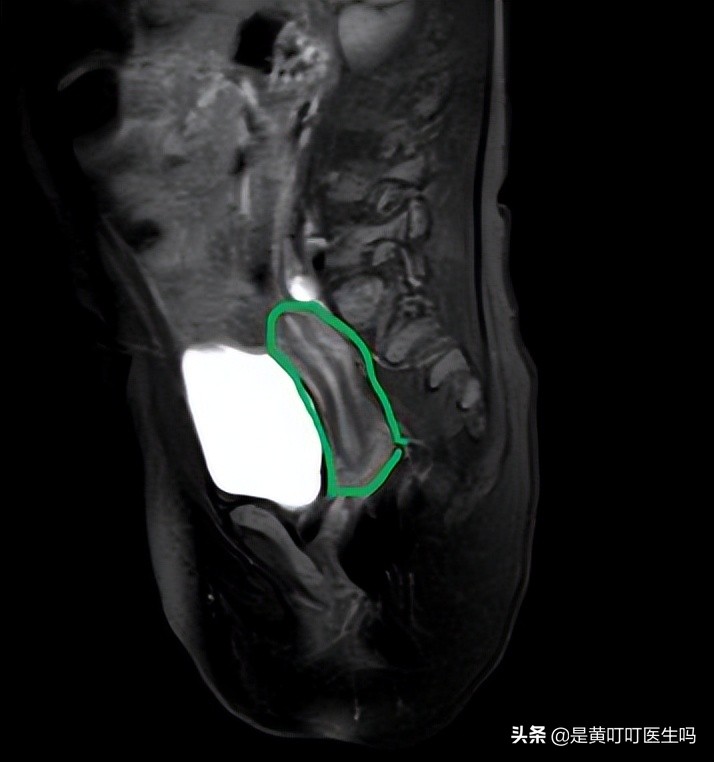 健康科普女生,科普女性健康体检