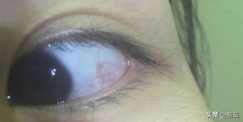 眼睛怎么才能变成星星眼,怎么让眼睛变星星眼