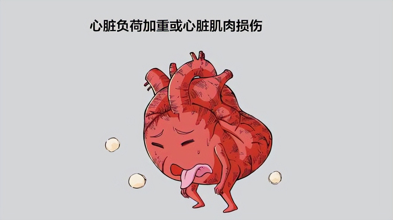 慢性心力衰竭如何确诊,慢性心力衰竭最长寿命