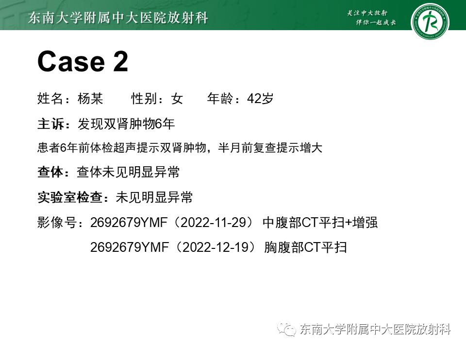 好文分享——《肾血管平滑肌脂肪瘤》