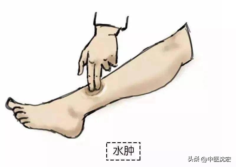 金匮肾气丸滋补肝肾多少钱,金匮肾气丸买一瓶够吗