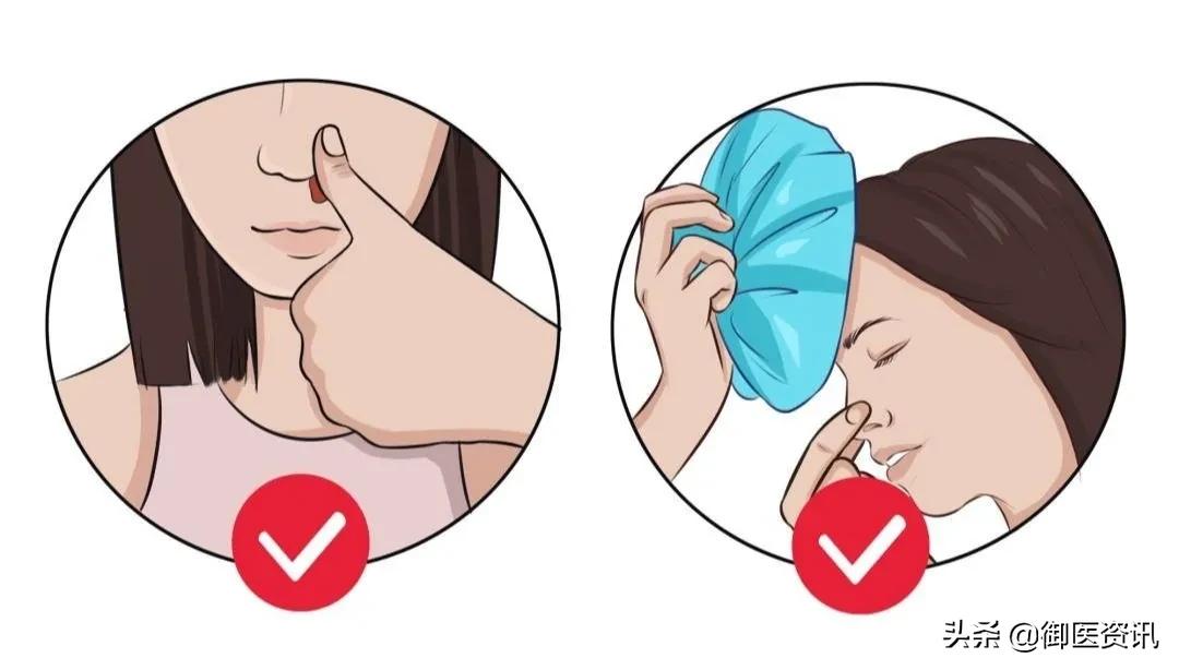 鼻出血不止时最有效的止血方法,鼻出血在身上快速止血穴位