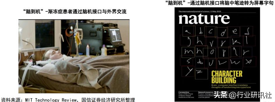 脑机接口发展现状及展望,脑机接口公司靠什么盈利