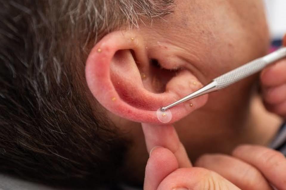 法国的国宝级老中医,中医药治老狗