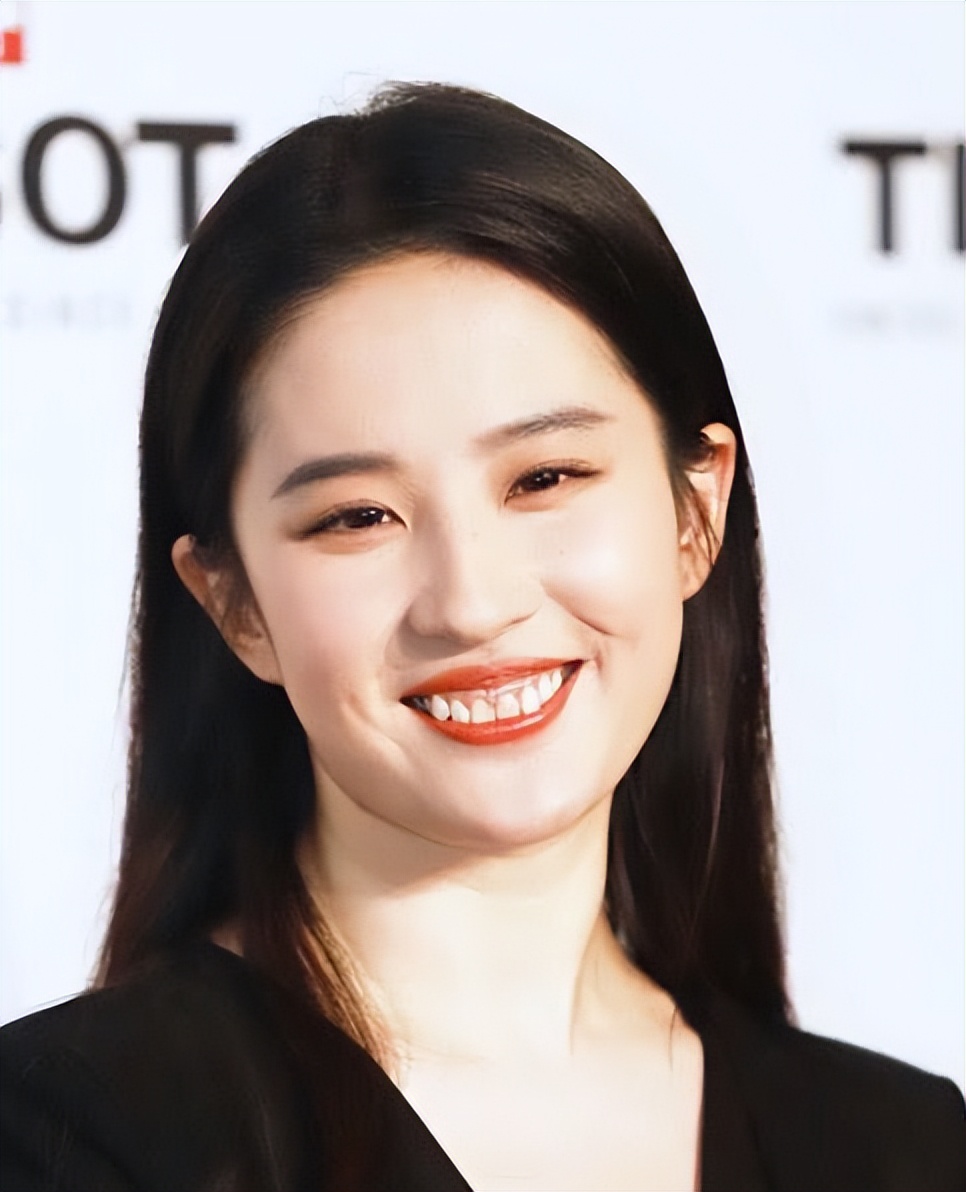 比“牙黄”更可怕的是“牙龈外露”，一笑就破功，很多明星都中招