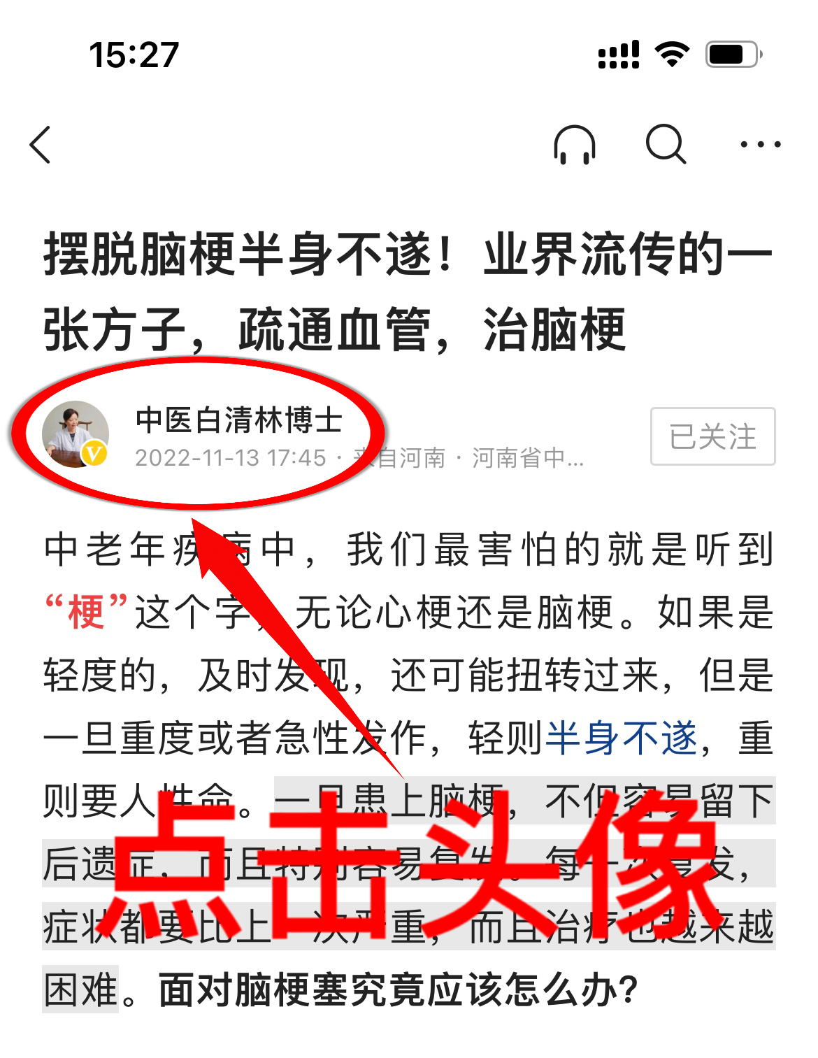 冠心病，心绞痛怎么办？圈内一张方子，化瘀通络，赶走冠心病