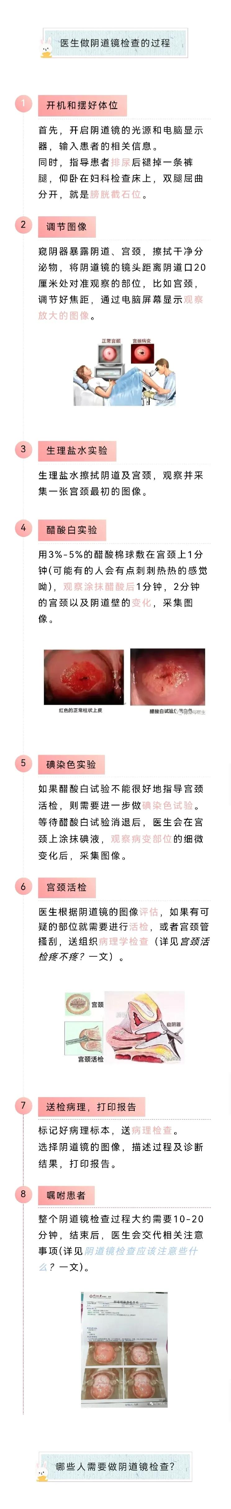 阴道镜检查是怎么回事？