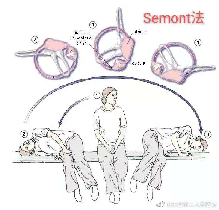 耳朵里的小石头,耳朵里像是有一个小石头