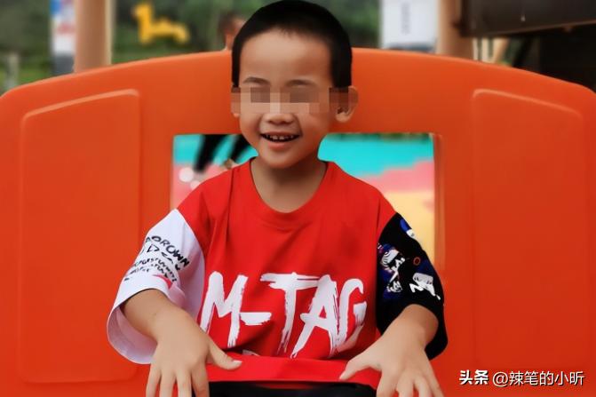 被泼硫酸毁容的16岁少女,十六岁花季少女被泼硫酸