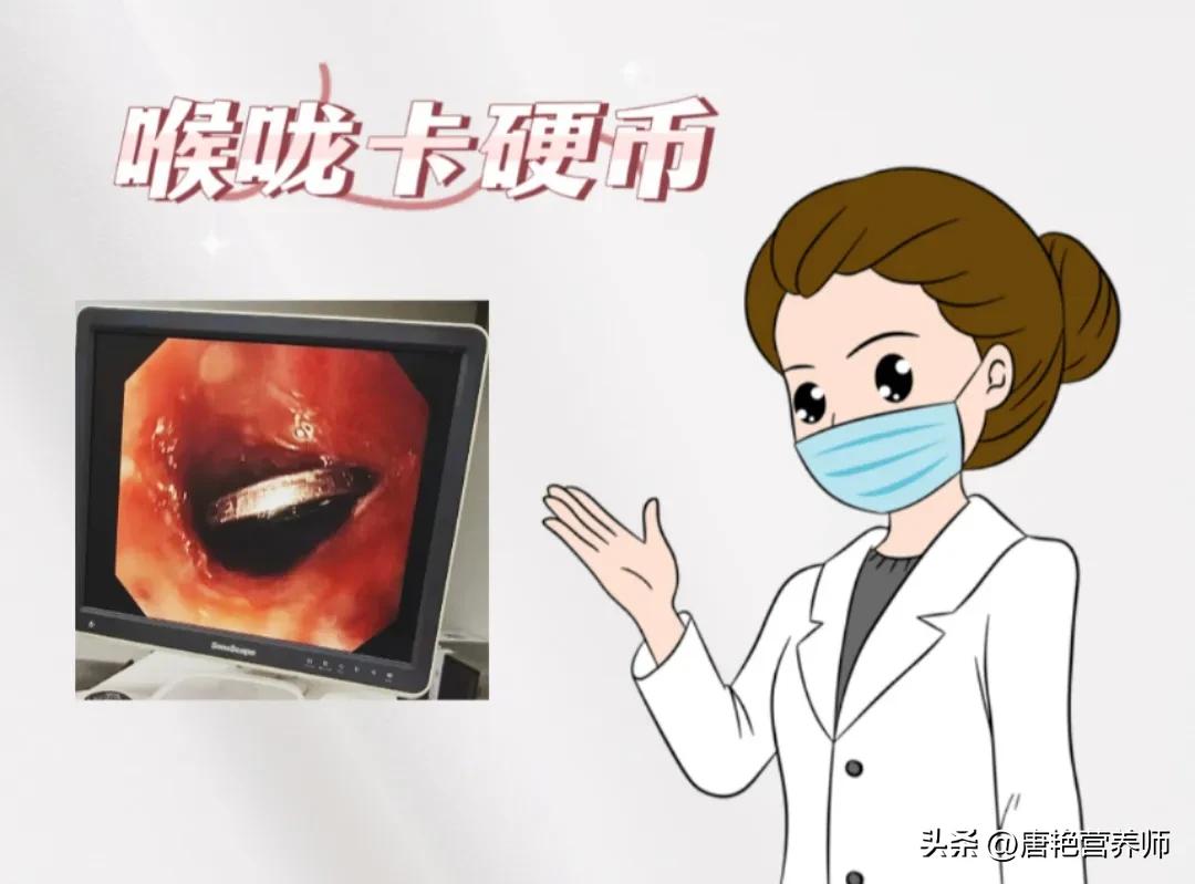 宝宝异物卡喉急救法,宝宝异物卡喉的紧急施救方法